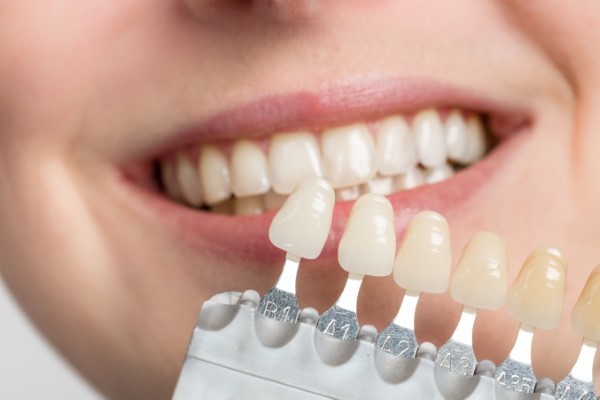 Veneers are all About Creating Beautiful Smiles