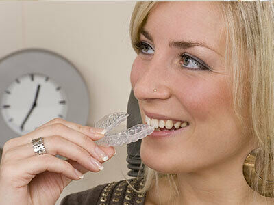 Invisalign